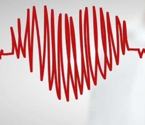 קרדיולוג ילדים בצפון